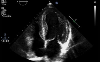 Simposio de Ecocardiografía y Doppler Cardíaco Fetal