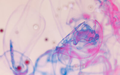 Linfocitopenia persistente en convalecientes de Covid-19: desregulación de los compartimentos de linfocitos B, T CD4+ y T reguladores en un grupo minoritario de casos moderados a graves