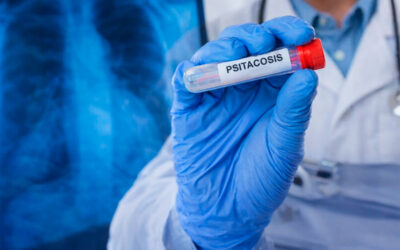 Aumento de casos de psitacosis: recomendaciones para la vigilancia, el diagnóstico y el manejo clínico en el contexto de neumonías grave