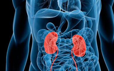 El riesgo de enfermedad renal aumenta tras la infección por Sars-Cov-2 en comparación con la gripe